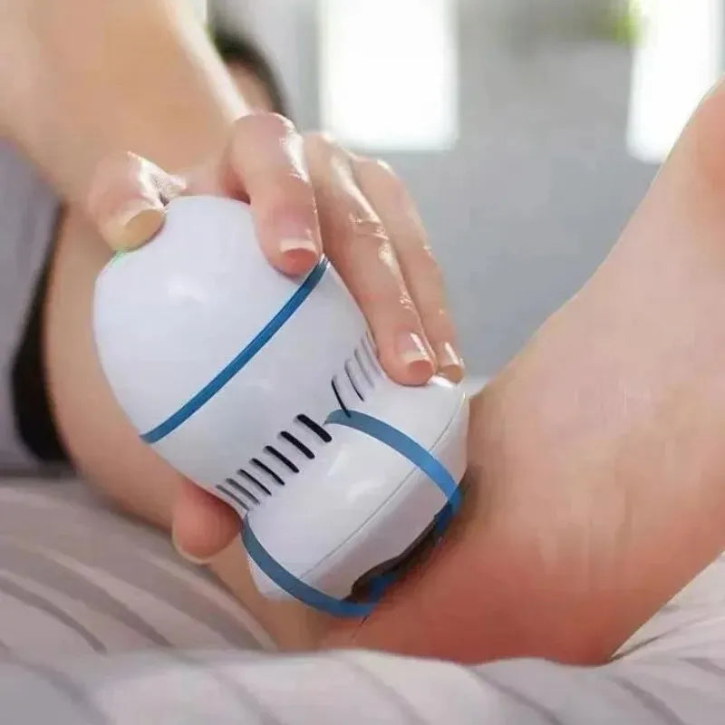 Electric Vacuum Foot Grinder – Pro Callus Remover & Pedicure