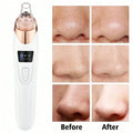Electric Facial Pore Cleanser Vacuum – Blackhead & Acne Remover