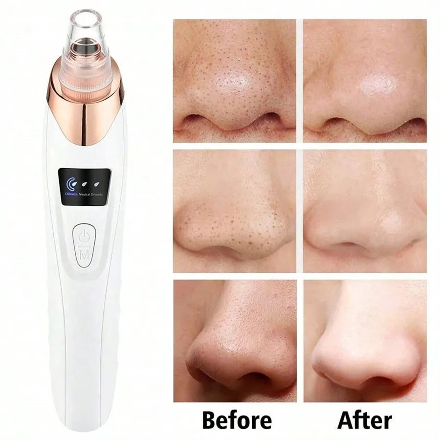 Electric Facial Pore Cleanser Vacuum – Blackhead & Acne Remover