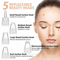 Electric Facial Pore Cleanser Vacuum – Blackhead & Acne Remover