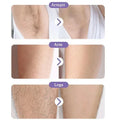 Magic Crystal Hair Eraser for Painless Hair Removal, Unisex
