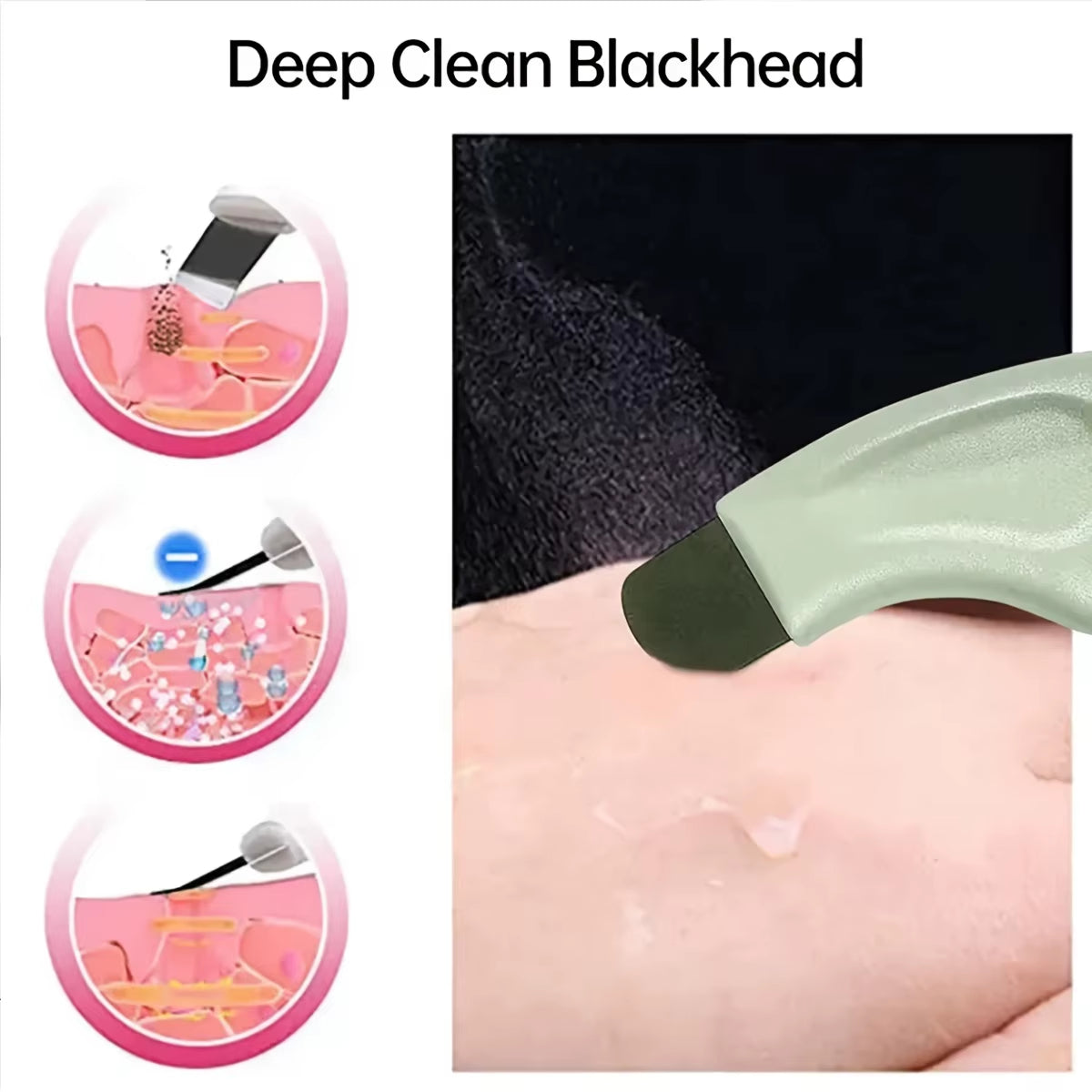Facial Blackhead Removal Tool, Deep Cleansing, Acne Removal